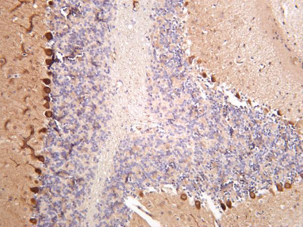 m01475 6 rps6kb1 primary antibodies ihc testing 1