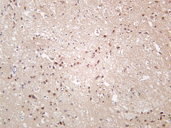 m01475 6 rps6kb1 primary antibodies ihc testing 2