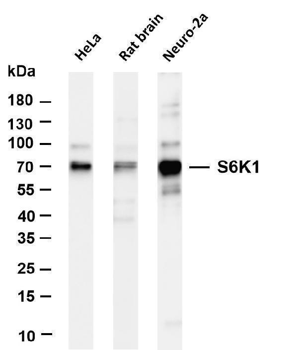 m01475 6 rps6kb1 primary antibodies wb testing 1