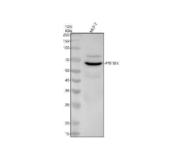 m01475 rps6kb1 primary antibodies wb testing 1