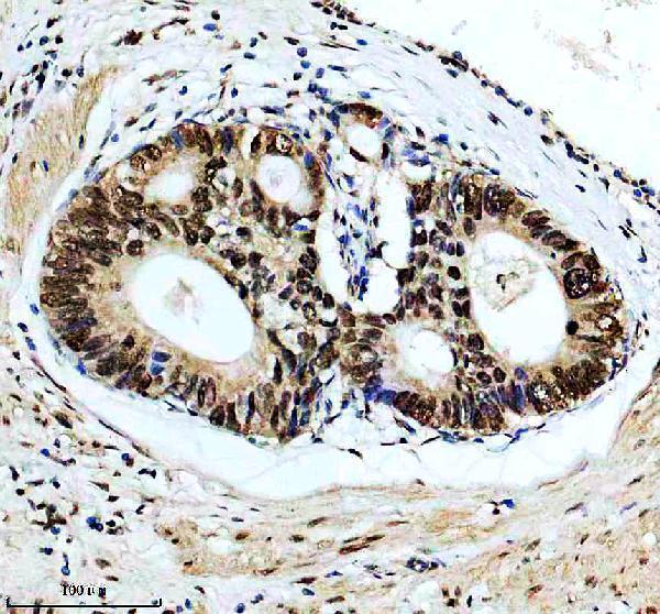 IHC analysis of HNRNPA1 using anti-HNRNPA1 antibody (M01476)