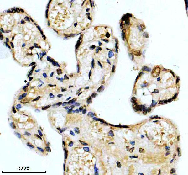 IHC analysis of HNRNPA1 using anti-HNRNPA1 antibody (M01476)