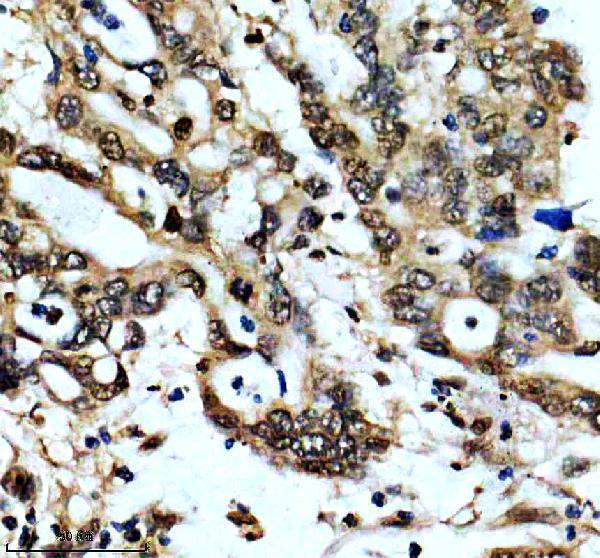 m01476 hnrnpa1 primary antibodies ihc testing 3