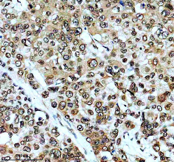m01476 hnrnpa1 primary antibodies ihc testing 4
