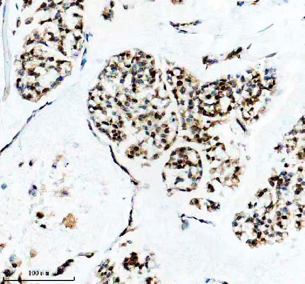 m01476 hnrnpa1 primary antibodies ihc testing 6