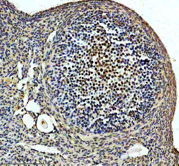 m01476 hnrnpa1 primary antibodies ihc testing 7