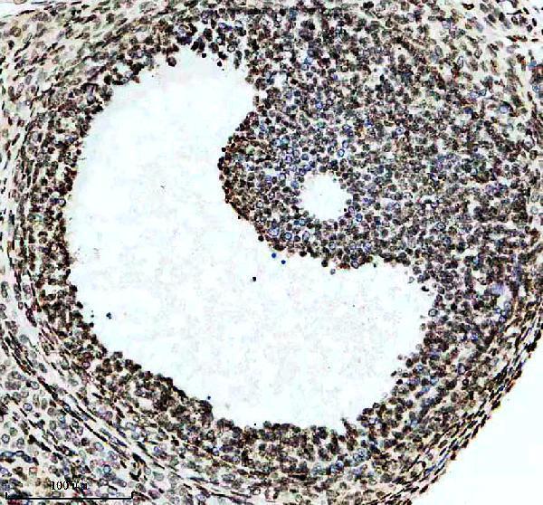 m01476 hnrnpa1 primary antibodies ihc testing 8