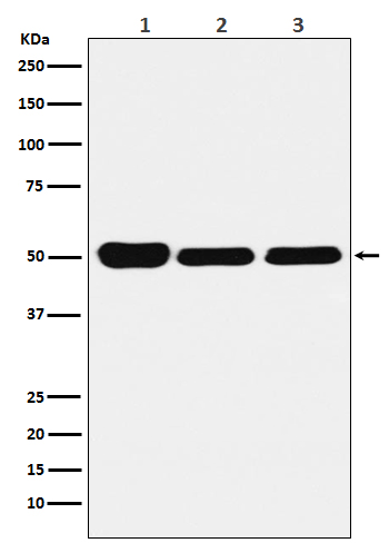 Western blot analysis of GLUR expression in (1) HeLa cell lysate; (2) Mouse brain lysate; (3) Rat kidney lysate