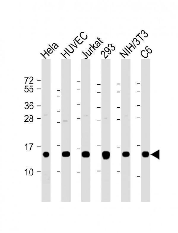 m01480 1 anti profilin 1 antibody wb testing 1