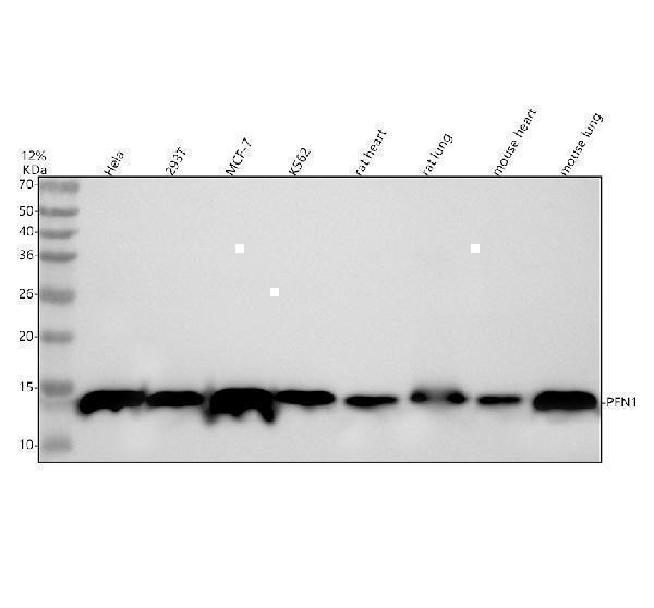m01480 pfn1 primary antibodies wb testing 1
