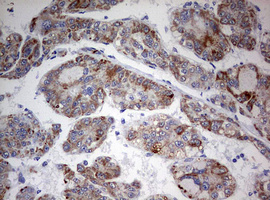 m01484 1 anti fen1 mouse monoclonal antibody clone id oti1f3 ihc testing 11