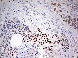 m01484 1 anti fen1 mouse monoclonal antibody clone id oti1f3 ihc testing 3
