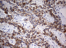 m01484 1 anti fen1 mouse monoclonal antibody clone id oti1f3 ihc testing 5