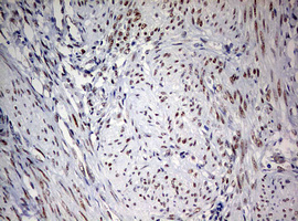 m01484 1 anti fen1 mouse monoclonal antibody clone id oti1f3 ihc testing 6