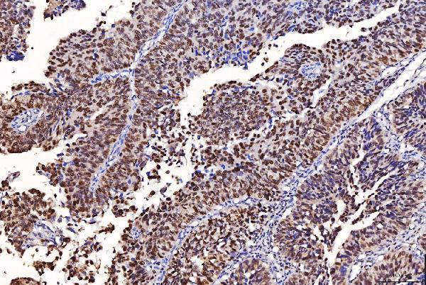  IHC analysis of FEN1 using anti-FEN1 antibody (M01484-3)