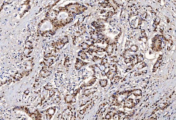  IHC analysis of FEN1 using anti-FEN1 antibody (M01484-3)