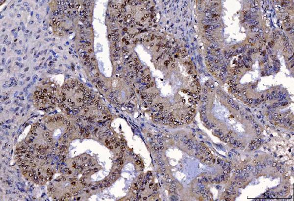 m01484 3 fen1 primary antibodies ihc testing 4