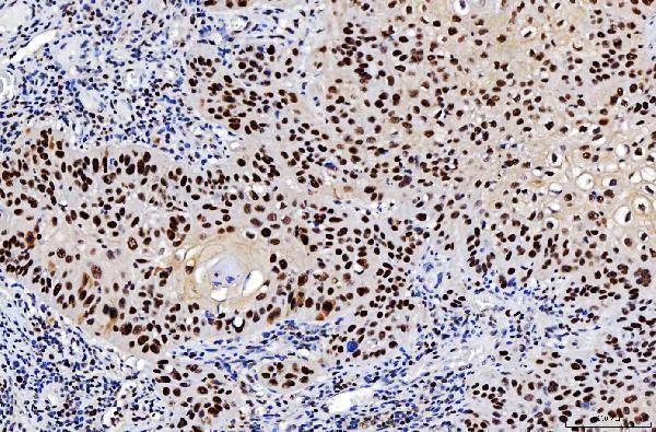 m01484 3 fen1 primary antibodies ihc testing 5