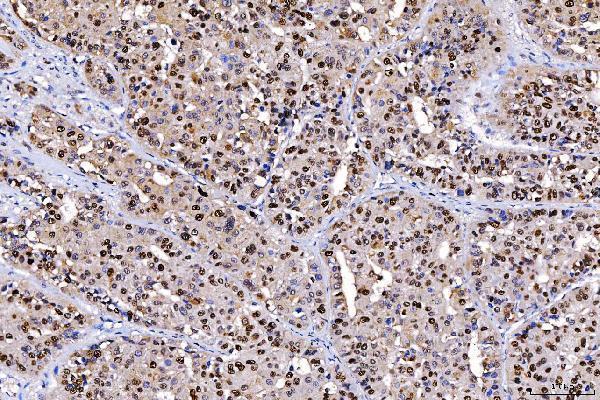 m01484 3 fen1 primary antibodies ihc testing 6