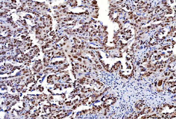 m01484 3 fen1 primary antibodies ihc testing 7