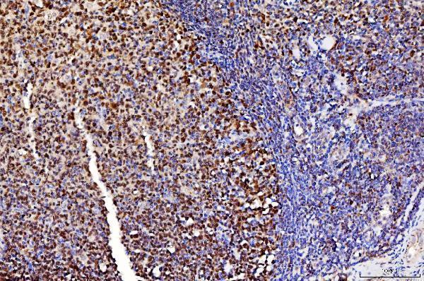 m01484 3 fen1 primary antibodies ihc testing 8