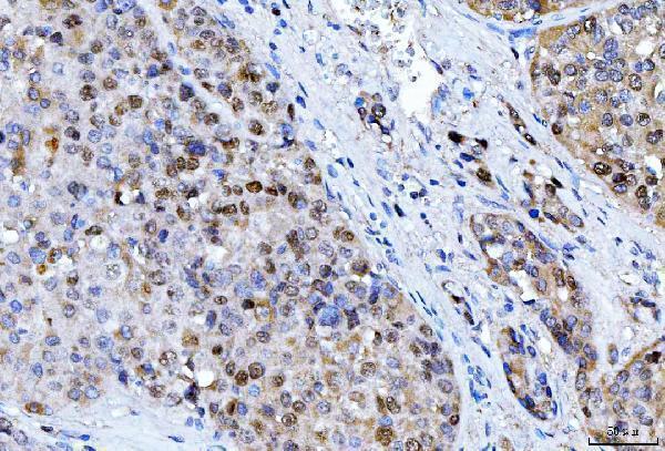  IHC analysis of FEN1 using anti-FEN1 antibody (M01484-4)