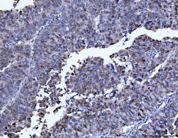  IHC analysis of FEN1 using anti-FEN1 antibody (M01484-4)