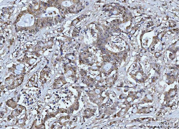 m01484 4 fen1 primary antibodies ihc testing 4