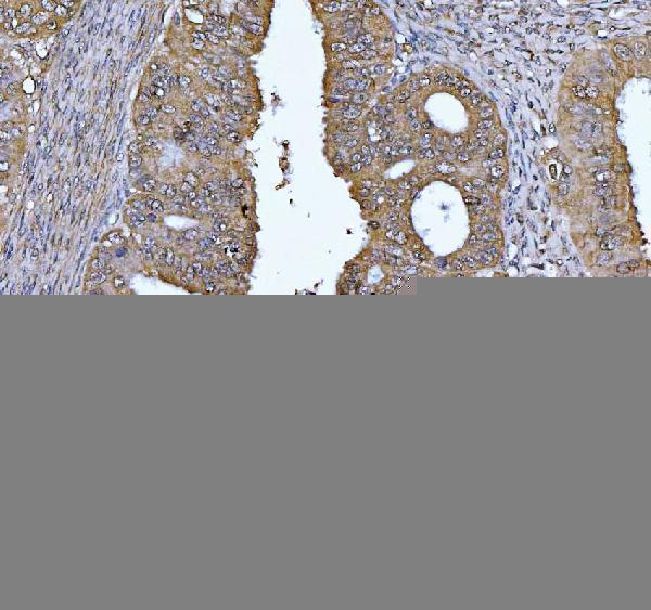 m01484 4 fen1 primary antibodies ihc testing 5