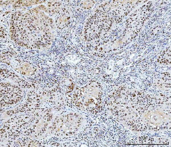 m01484 4 fen1 primary antibodies ihc testing 6