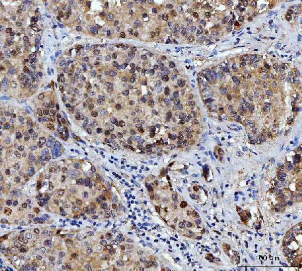 m01484 4 fen1 primary antibodies ihc testing 7