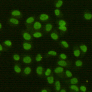 m01484 fen1 primary antiboties icc testing 2