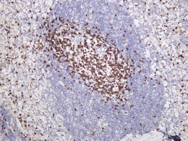 Mouse spleen was stained with anti-Ctip2 rabbit antibody