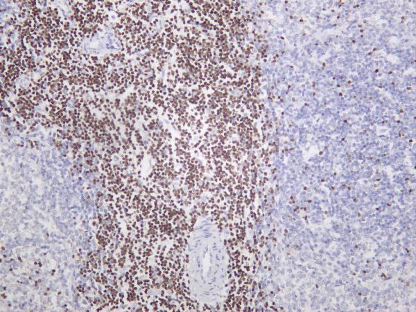Rat spleen was stained with anti-Ctip2 rabbit antibody