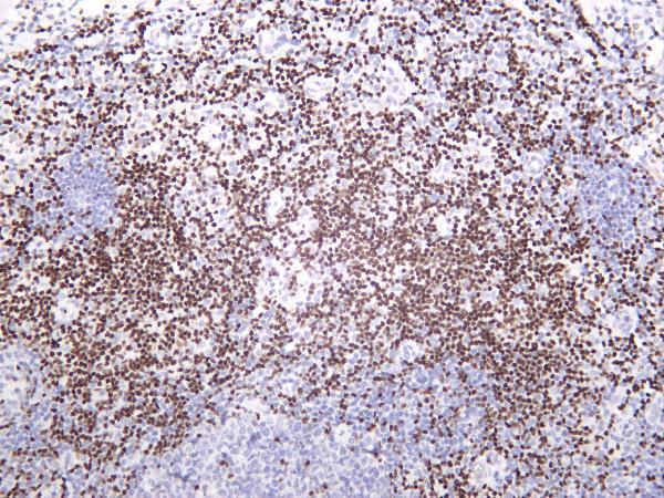 Human tonsil was stained with anti-Ctip2 rabbit antibody