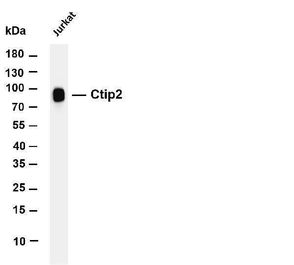 m01485 2 bcl11b primary antibodies wb testing 1