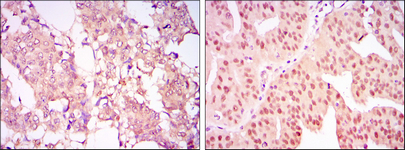 m01486 1 carm1 primary antibodies ihc testing 3