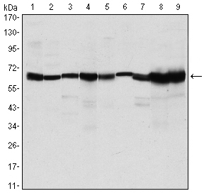 m01486 1 carm1 primary antibodies wb testing 2