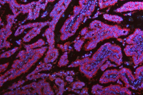  IF analysis of MET using anti-MET antibody (M01488)
