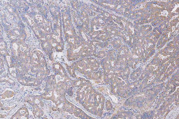  IHC analysis of MET using anti-MET antibody (M01488)