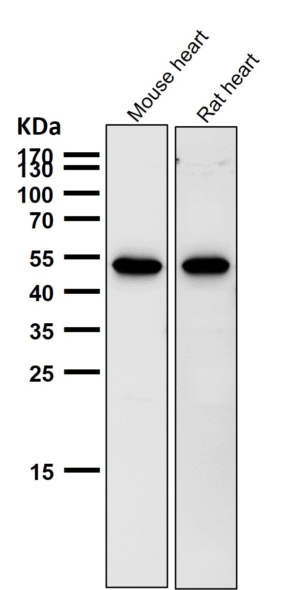 All lanes use the Antibody at 1:1K dilution for 1 hour at room temperature