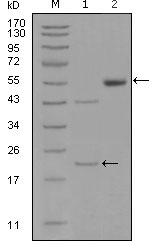 Western blotting validation for Anti-Ephrin type-A receptor 5 EphA5 Monoclonal Antibody M01494
Western Blot (WB) analysis using EphA5 Monoclonal Antibody against truncated EPHA5-His recombinant protein (1) and truncated EPHA5(aa620-774)-hIgGFc transfected CHO-K1 cell lysate(2)