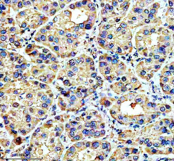 IHC analysis of A2M using anti-A2M antibody (M01498)