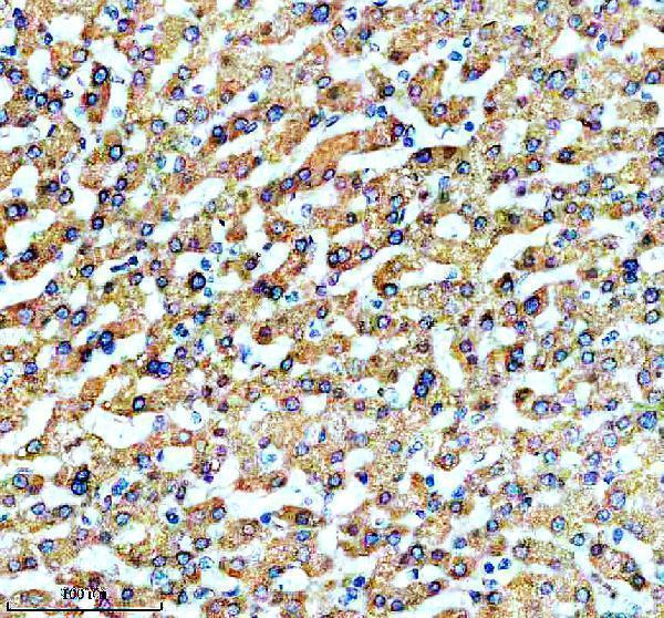 IHC analysis of A2M using anti-A2M antibody (M01498)