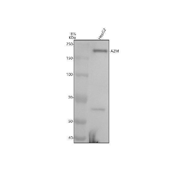 Western blot analysis of A2M using anti-A2M antibody (M01498)