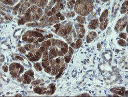 Immunohistochemical staining of paraffin-embedded Human pancreas tissue within the normal limits using anti-CDKN2B mouse monoclonal antibody