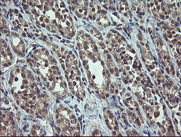 m01500 anti p15 ink4b cdkn2b mouse monoclonal antibody clone id oti3b6 ihc testing 4