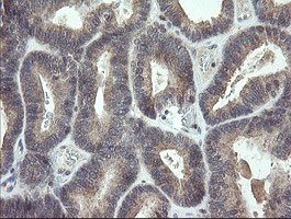 m01500 anti p15 ink4b cdkn2b mouse monoclonal antibody clone id oti3b6 ihc testing 5