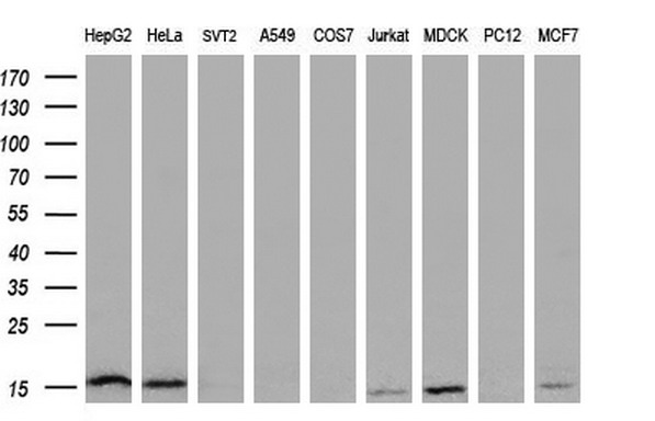 Western blot analysis of extracts (35ug) from 9 different cell lines by using anti-CDKN2B monoclonal antibody (HepG2: human; HeLa: human; SVT2: mouse; A549: human; COS7: monkey; Jurkat: human; MDCK: canine; PC12: rat; MCF7: human) (1:200)