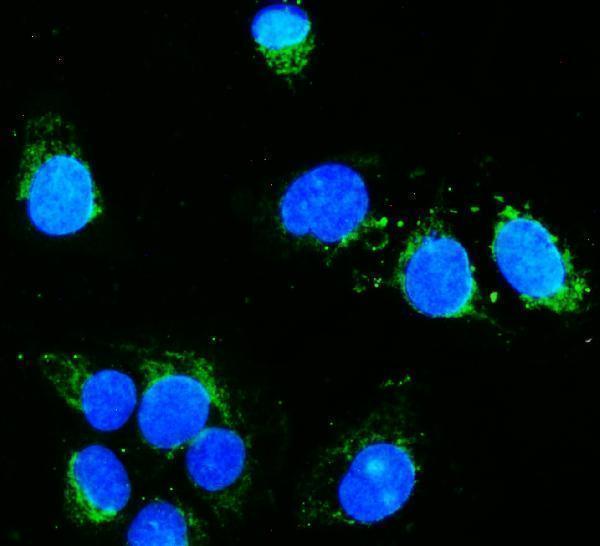 m01504 1 hk1 primary antibodies if testing 6